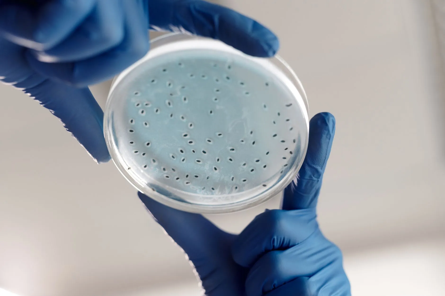 从乳酸菌到益生元：山东爱泽生物益生菌颗粒配方设计思路解读正文配图 1